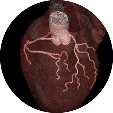 Cardiac & Vascular Imaging Image