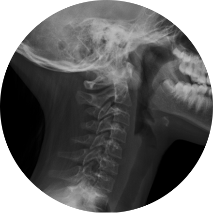 Digital X-ray Image